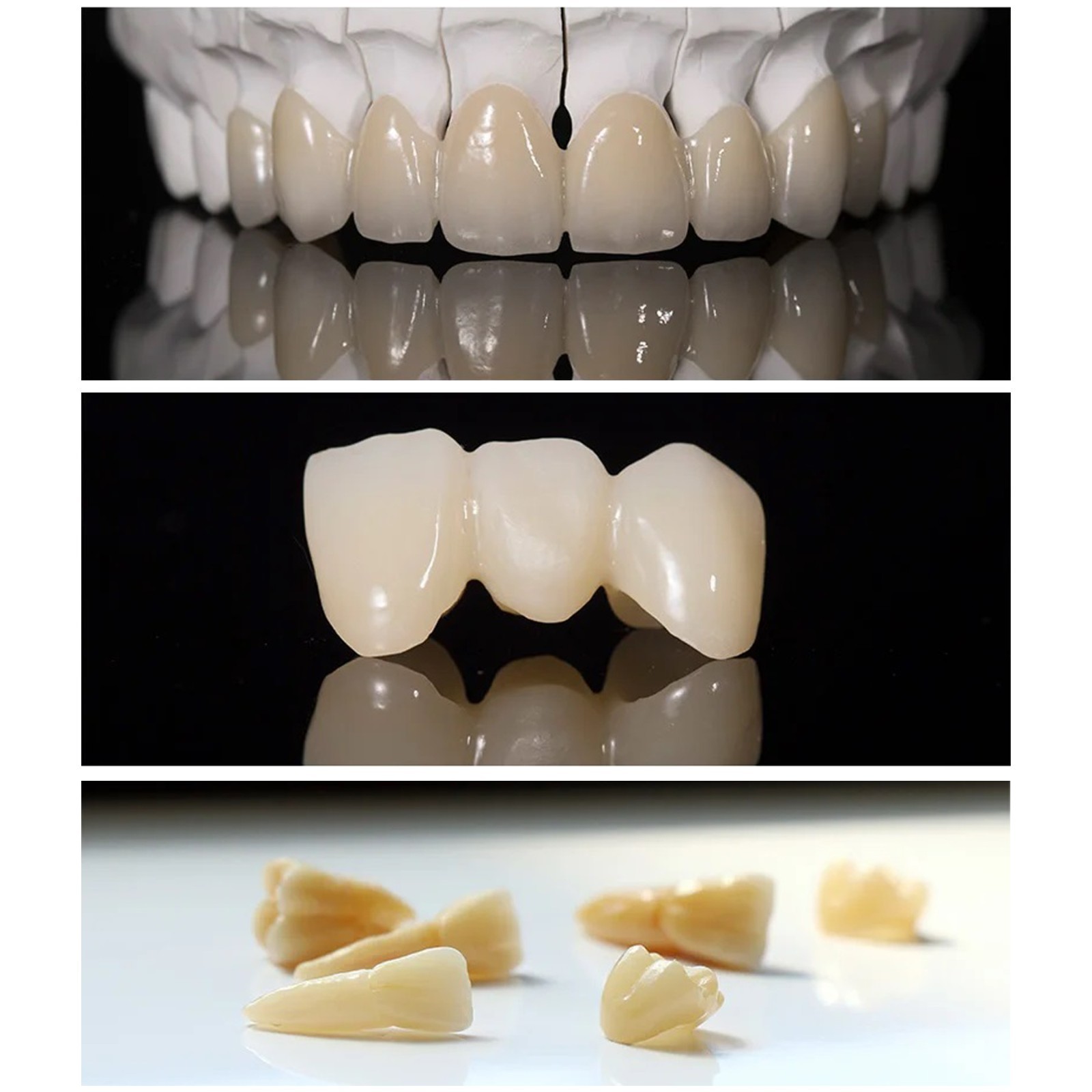 US Emax CAD C14 Dental Lithium Disilicate Block CEREC Milling Posterior Crown