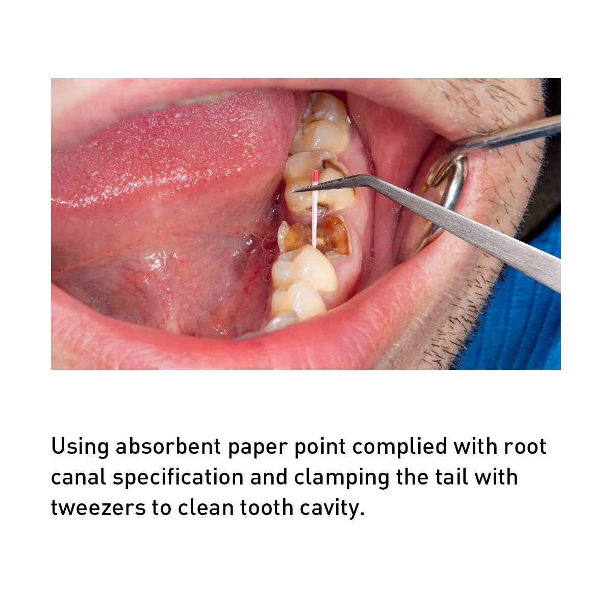 AZDENT Dental Absorbent Paper Point Endodontic Root Canal Clean Taper.02/.04/.06