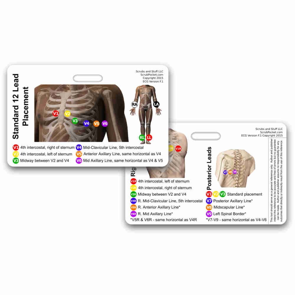 12 Lead EKG Placement Horizontal Badge Reference 1 Count (Pack of 1), White