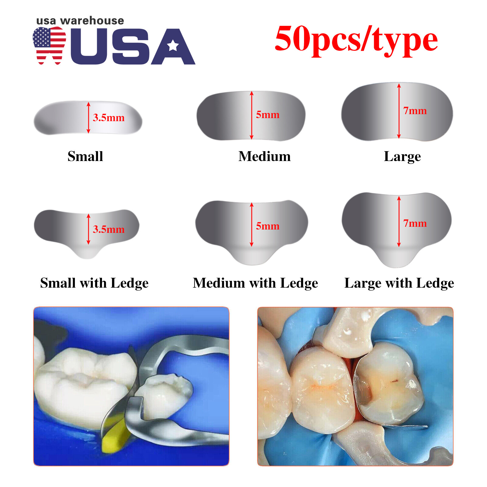 50pcs Dental Metal Matrices Sectional Contoured Matrix Refill band S/M/L [USA]