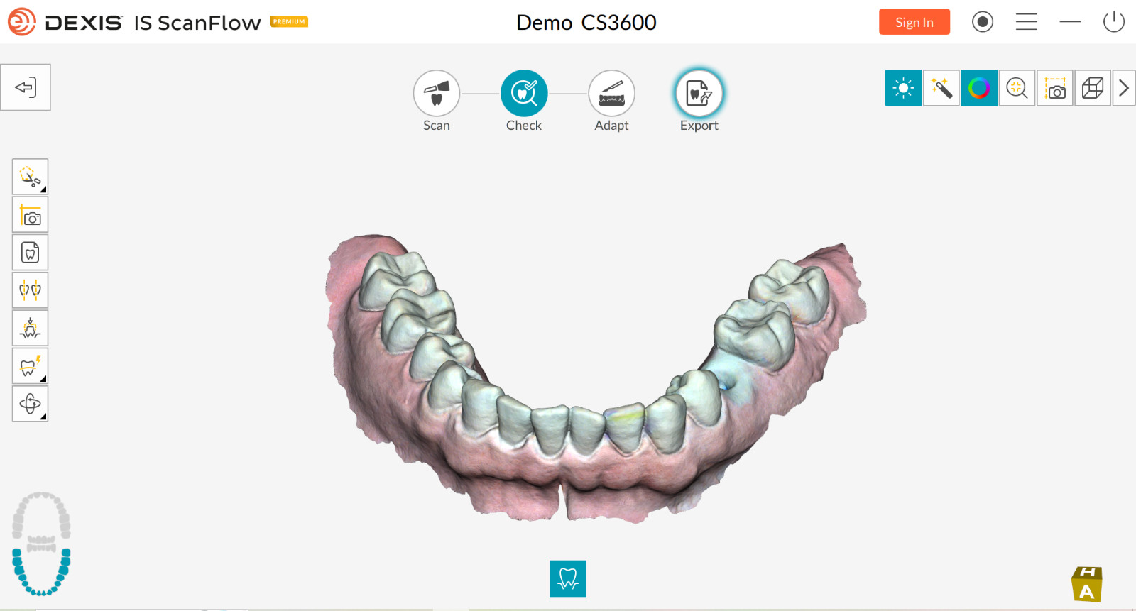 2020 Carestream CS3600 Intraoral Scanner CAD/CAM – Express Shipping