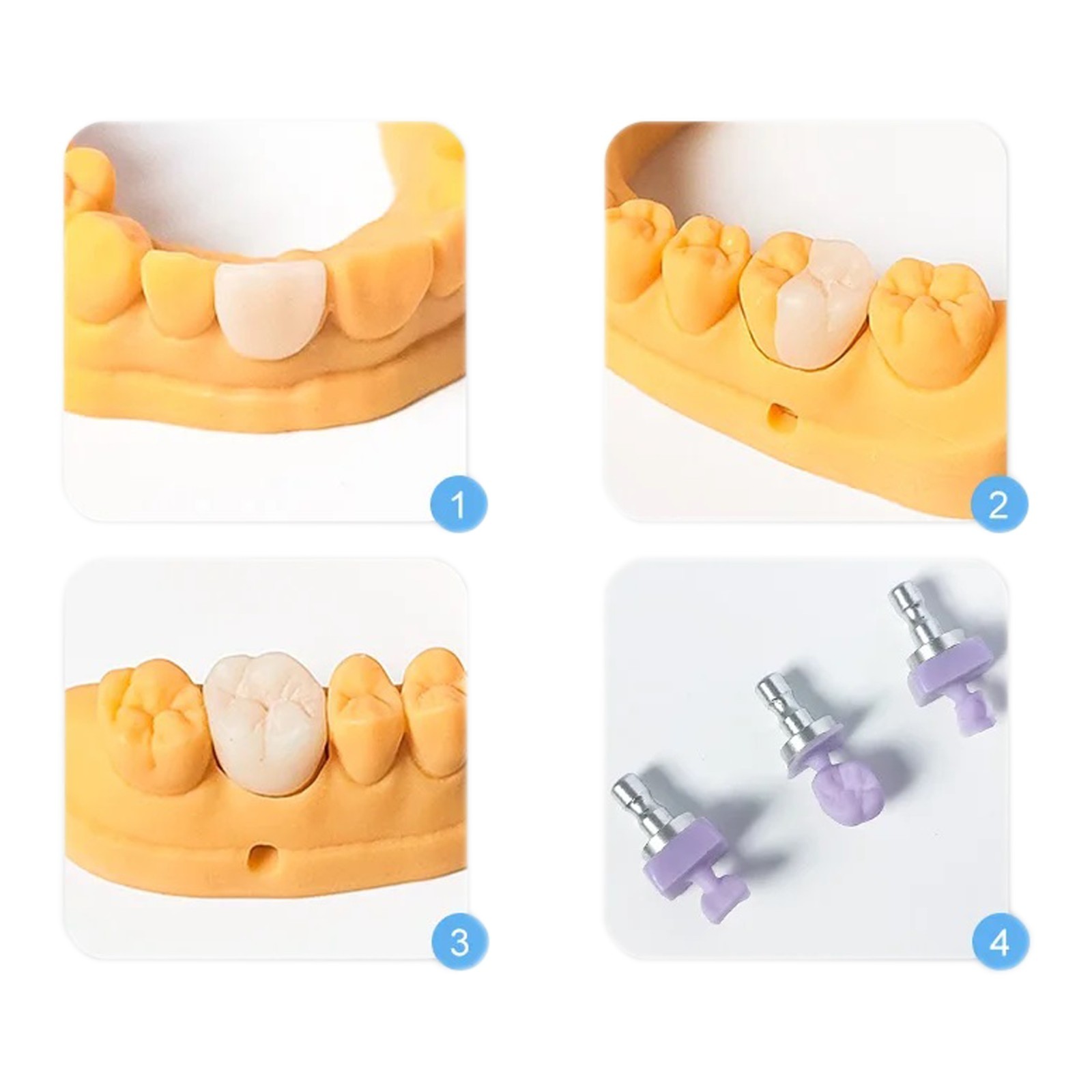 C14 Dental Lithium Disilicate Glass-ceramic Blocks HT/LT Emax Chairside CAD/CAM